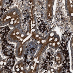 BAIAP2L1 Antibody, Novus Biologicals 0.1mL; Unlabeled:Antibodies, Polyclonal