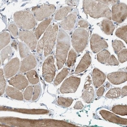 BAIAP2L1 Antibody, Novus Biologicals 0.1mL; Unlabeled:Antibodies, Polyclonal