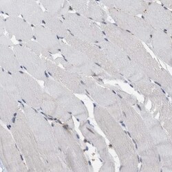 BAIAP2L1 Antibody, Novus Biologicals 25 &mu;L | Buy Online | Novus Biologicals | Fisher Scientific