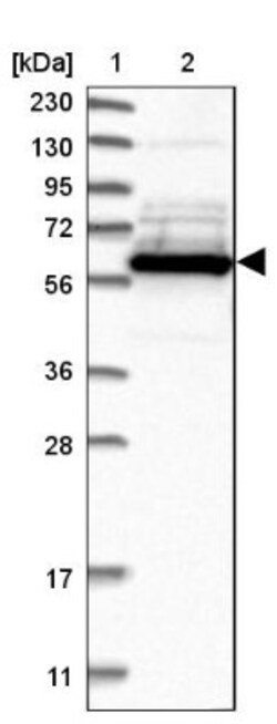 BAIAP2L1 Antibody, Novus Biologicals 25 &mu;L; Unlabeled:Antibodies, Polyclonal