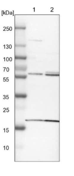 BAIAP2L1 Antibody, Novus Biologicals 0.1mL; Unlabeled:Antibodies, Polyclonal