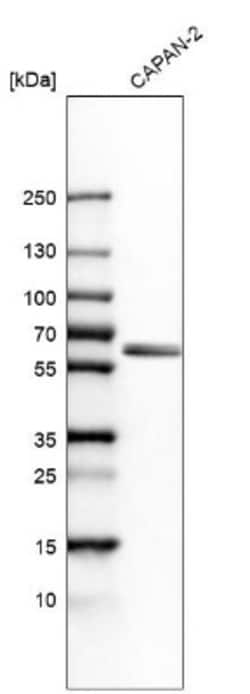 BAIAP2L1 Antibody, Novus Biologicals 0.1mL; Unlabeled:Antibodies, Polyclonal