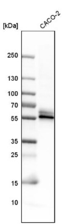 BAIAP2L1 Antibody, Novus Biologicals 25 &mu;L | Buy Online | Novus Biologicals | Fisher Scientific