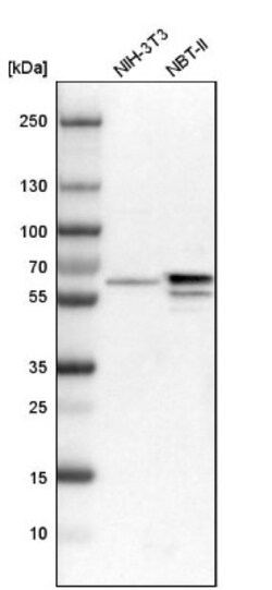 BAIAP2L1 Antibody, Novus Biologicals 25 &mu;L | Buy Online | Novus Biologicals | Fisher Scientific