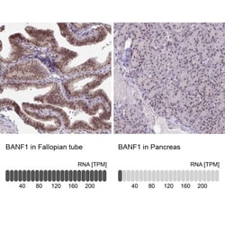 BANF1 Antibody, Novus Biologicals 0.1mL; Unlabeled:Antibodies, Polyclonal