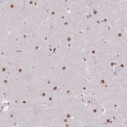 BARD1 Antibody, Novus Biologicals:Anticuerpos:Anticuerpos primarios