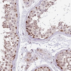 BARD1 Antibody, Novus Biologicals:Anticuerpos:Anticuerpos primarios