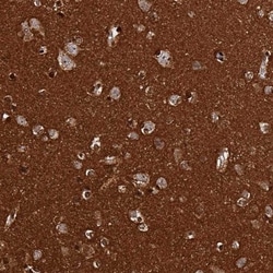 BASP1 Antibody, Novus Biologicals 25ul | Buy Online | Novus Biologicals | Fisher Scientific