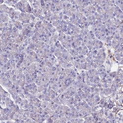 BASP1 Antibody, Novus Biologicals 25ul | Buy Online | Novus Biologicals | Fisher Scientific