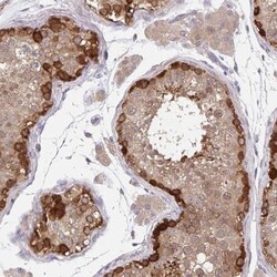 BAT3/BAG6 Antibody, Novus Biologicals:Antibodies:Primary Antibodies