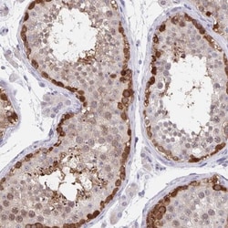BAT3/BAG6 Antibody, Novus Biologicals 25 &mu;L | Buy Online | Novus Biologicals | Fisher Scientific