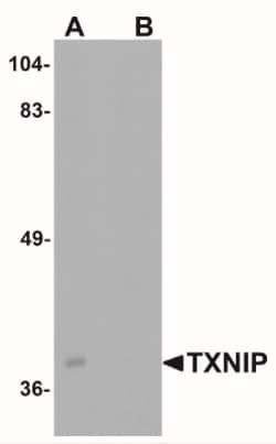 BATF3 Antibody - BSA Free, Novus Biologicals:Antibodies:Primary Antibodies