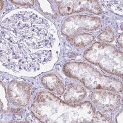 BBS1 Antibody, Novus Biologicals:Antibodies:Primary Antibodies