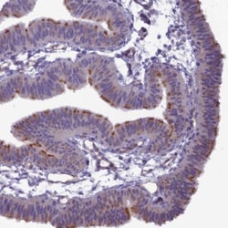 BBS7 Antibody, Novus Biologicals:Antibodies:Primary Antibodies