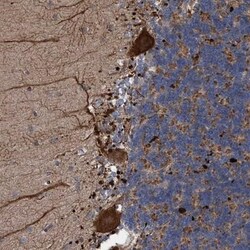 BBS9 Antibody, Novus Biologicals 0.1mL; Unlabeled:Antibodies, Polyclonal