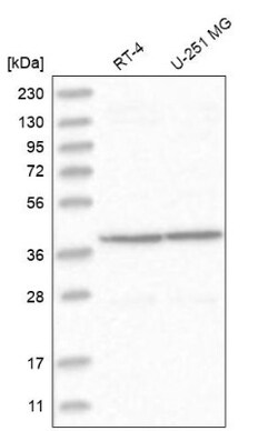 BBS9 Antibody, Novus Biologicals 0.1mL; Unlabeled:Antibodies, Polyclonal