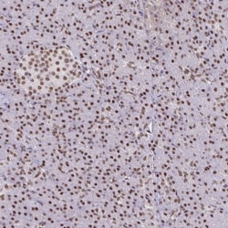 BBX Antibody, Novus Biologicals:Antibodies:Primary Antibodies