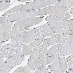 BBX Antibody, Novus Biologicals 25 &mu;L; Unlabeled:Antibodies, Polyclonal