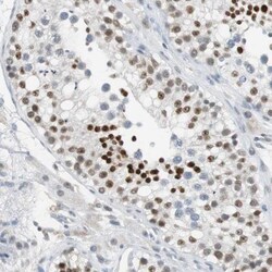 BBX Antibody, Novus Biologicals 25 &mu;L; Unlabeled:Antibodies, Polyclonal