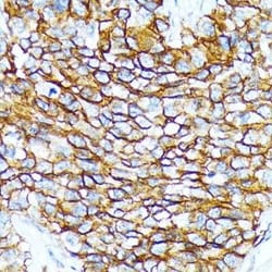 BCAM/CD239 Rabbit anti-Human, Mouse, Rat, Clone: 1G9W3, Novus Biologicals:Antibodies:Primary