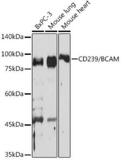 BCAM/CD239 Rabbit anti-Human, Mouse, Rat, Clone: 1G9W3, Novus Biologicals:Antibodies:Primary