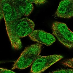BCAP/PIK3AP1 Antibody, Novus Biologicals 0.1mL; Unlabeled:Antibodies, Polyclonal