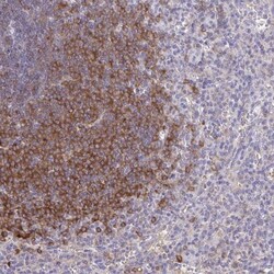 BCAP/PIK3AP1 Antibody, Novus Biologicals 0.1mL; Unlabeled:Antibodies, Polyclonal