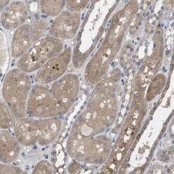 BCAR3 Antibody, Novus Biologicals 0.1mL; Unlabeled:Antibodies, Polyclonal