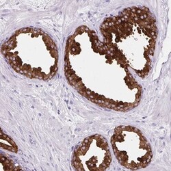 BCAS1 Antibody, Novus Biologicals 25 &mu;L, Unlabeled:Antibodies, Polyclonal
