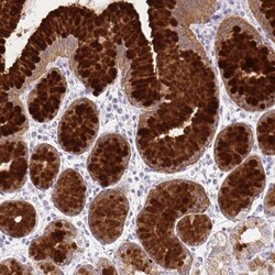 BCAS1 Antibody, Novus Biologicals 25 &mu;L, Unlabeled:Antibodies, Polyclonal