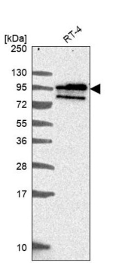 BCAS1 Antibody, Novus Biologicals 25 &mu;L, Unlabeled:Antibodies, Polyclonal
