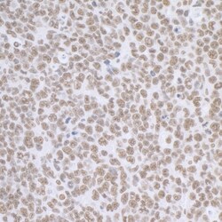BCAS2 Antibody, Novus Biologicals 100 &mu;L | Buy Online | Novus Biologicals | Fisher Scientific