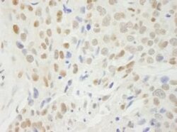BCAS2 Antibody, Novus Biologicals 100 &mu;L | Buy Online | Novus Biologicals | Fisher Scientific