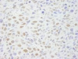 BCAS2 Antibody, Novus Biologicals 100 &mu;L | Buy Online | Novus Biologicals | Fisher Scientific