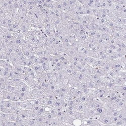 BCAT2 Antibody, Novus Biologicals 0.1mL; Unlabeled:Antibodies, Polyclonal
