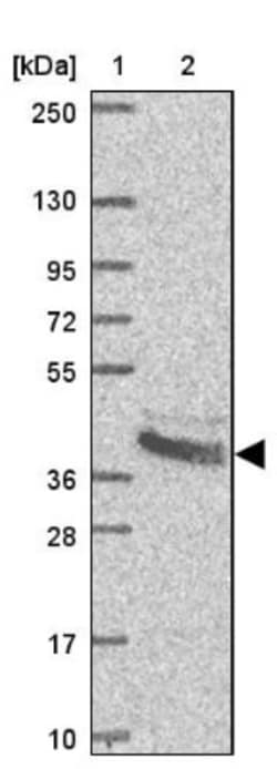 BCAT2 Antibody, Novus Biologicals 0.1mL; Unlabeled:Antibodies, Polyclonal