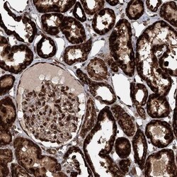 BCKDHA Antibody, Novus Biologicals:Antibodies:Primary Antibodies