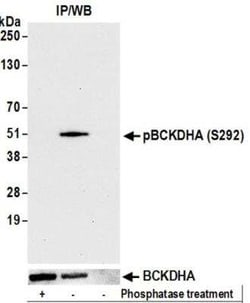 BCKDHA Antibody (BLR060F), Novus Biologicals 100 &mu;g; Unconjugated:Antibodies,