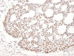 BCL11B Antibody, Novus Biologicals 0.1mL; Unlabeled:Antibodies, Polyclonal