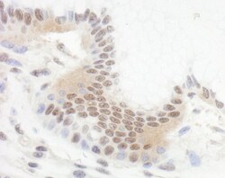 BCL11B Antibody, Novus Biologicals 0.1mL; Unlabeled:Antibodies, Polyclonal