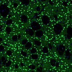 BCL11B Antibody, Novus Biologicals 25 &mu;L, Unlabeled:Antibodies, Polyclonal