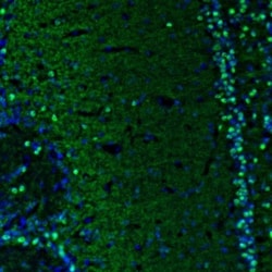 BCL11B Antibody, Novus Biologicals 25 &mu;L, Unlabeled:Antibodies, Polyclonal