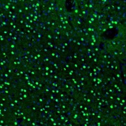 BCL11B Antibody, Novus Biologicals 25 &mu;L, Unlabeled:Antibodies, Polyclonal