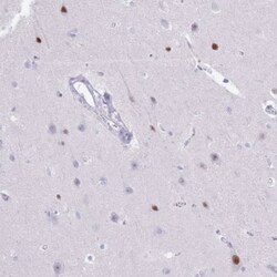 BCL11B Antibody, Novus Biologicals 25 &mu;L, Unlabeled:Antibodies, Polyclonal