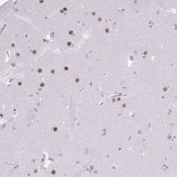 BCL11B Antibody, Novus Biologicals 25 &mu;L, Unlabeled:Antibodies, Polyclonal