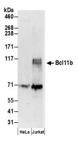 BCL11B Antibody, Novus Biologicals 0.1mL; Unlabeled:Antibodies, Polyclonal
