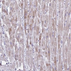 BCL6B Antibody, Novus Biologicals:Antibodies:Primary Antibodies
