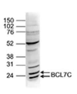 BCL7C Rabbit anti-Human, Polyclonal, Novus Biologicals 25 &mu;g | Buy Online | Novus Biologicals | Fisher Scientific
