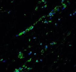BCL9-2 Antibody - BSA Free, Novus Biologicals 0.1mg; Unlabeled:Antibodies,