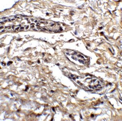 BCL9-2 Antibody - BSA Free, Novus Biologicals 0.1mg; Unlabeled:Antibodies,